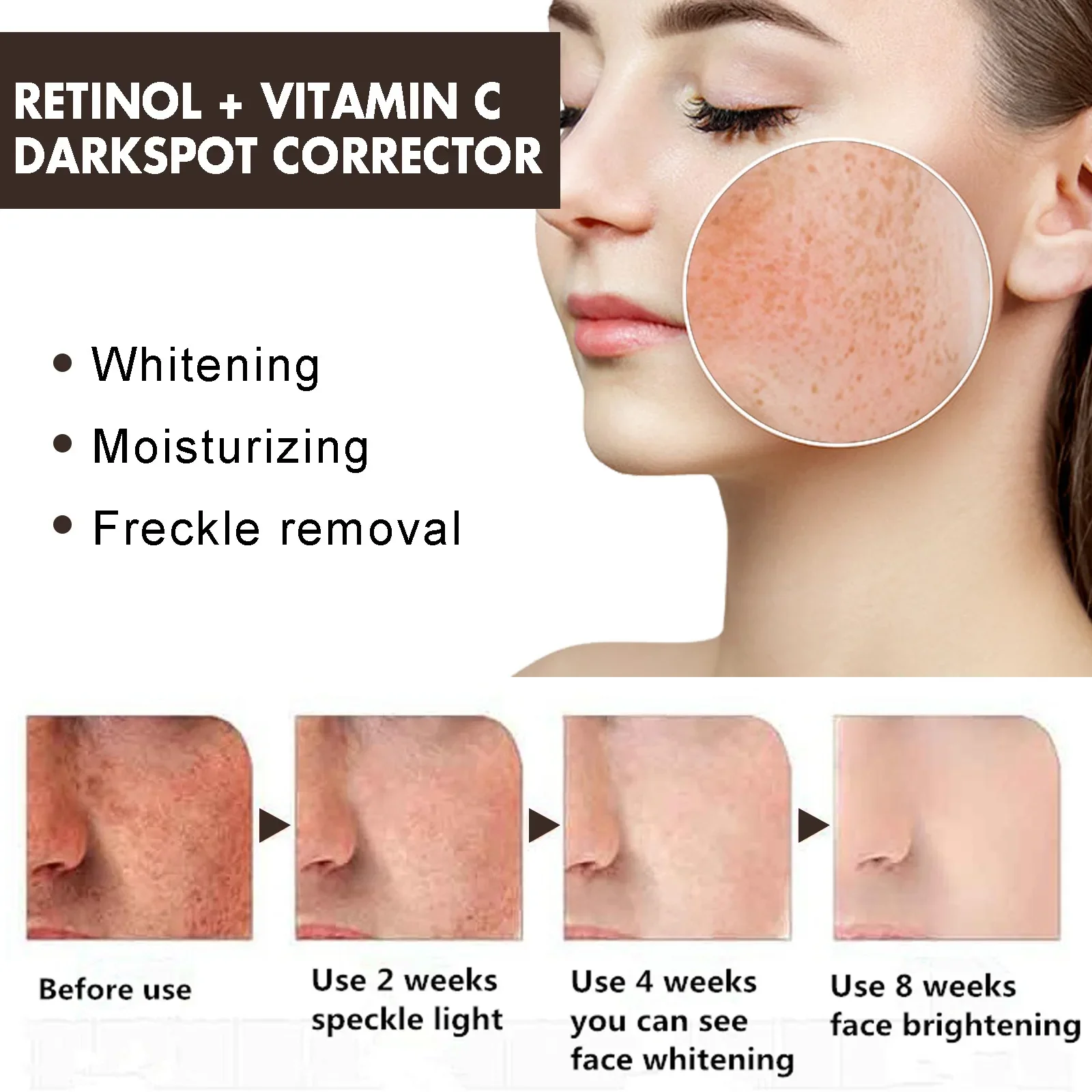 Eelhoe Dark Spot Repair Cream Fade Dark Spot Melasma Moisture Replenishment Smooth Skin Facial Neck Cream Skin Whitening Cream