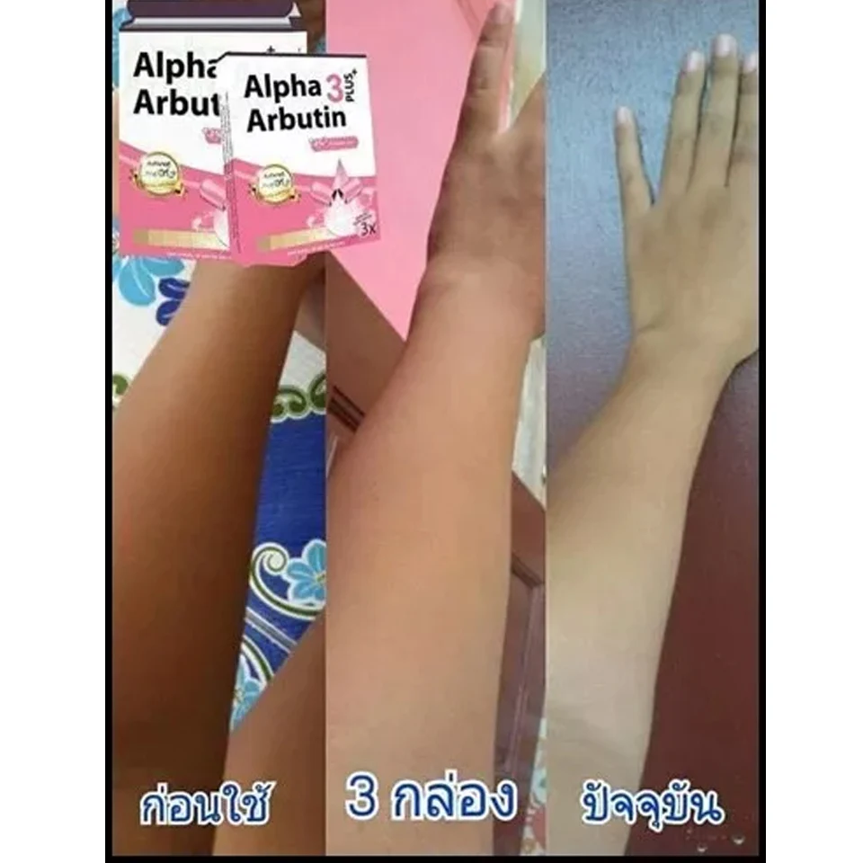 Alpha Arbutin Pó Mix com Loção, clareamento da pele, iluminar, reduzir manchas de pele escura, 3X