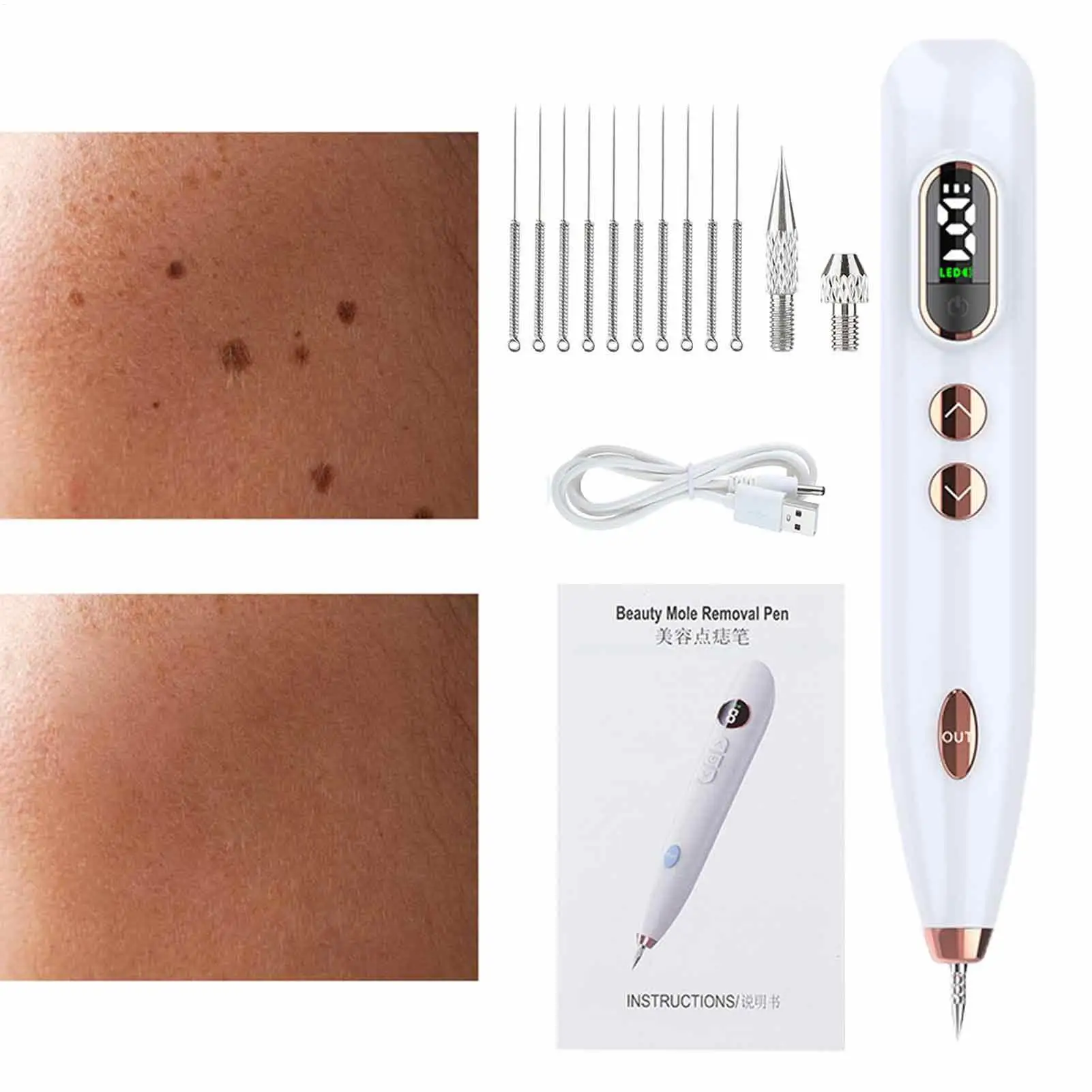 USB Charge Electronic Face Skin Scar Removal Pens Repairing Skin Machine For Dark Spot Birthday Dating Gift For Friends Neighbor