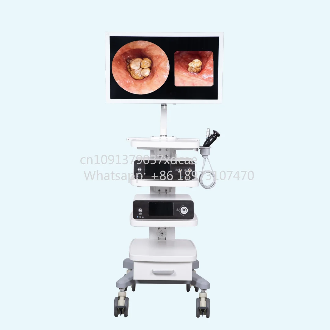 2026 New 32 Inches 4k Screen Endoscopy Imaging Equipment Tower Endoscope Camera System Trolley​
