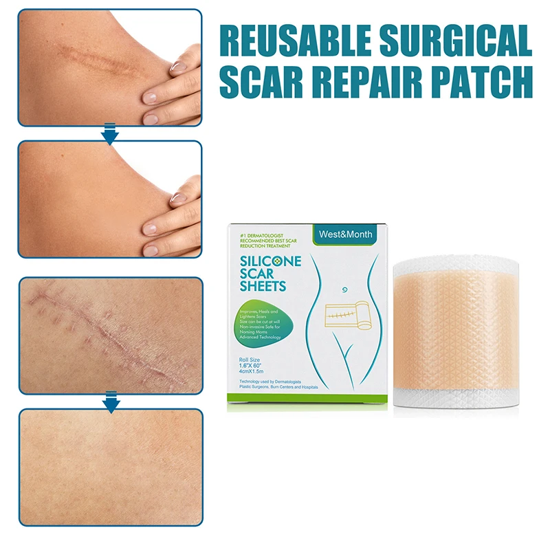 New Silicone Scar Patch To Remove Hidden Concealer Ointment Pad Gel Waterproof Tape For Treatment Of Keloid Burn Tummy Tuck
