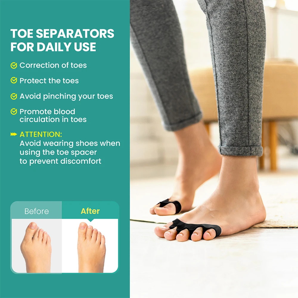 

2Pcs Sumifun Black Gel Five Holes Toe Separator Bunion Hallux Valgus Correction Toes Overlap Orthopedics Foot Clamp Protector