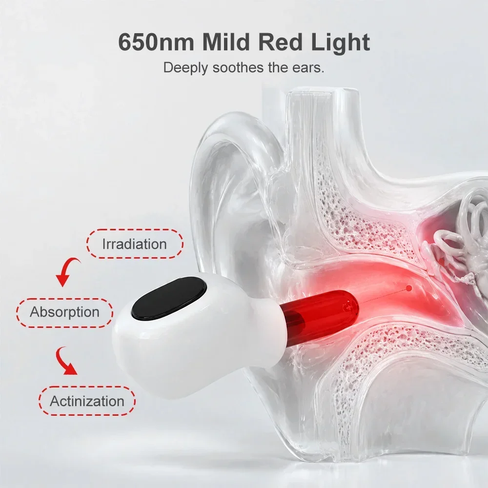 650nm Ohrstöpsel für Mittelohrentzündung, Rotlichttherapie-Laser zur Bestrahlung des Gehörgangs, Laser gegen Tinnitus und Taubheit, Physiotherapie-Gerät – Detail 2