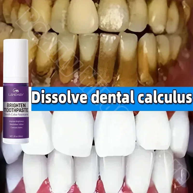 V34 dentifricio sbiancante per denti rimuovi macchie di placca pulizia igiene orale sbiancamento strumenti dentali alito fresco cura