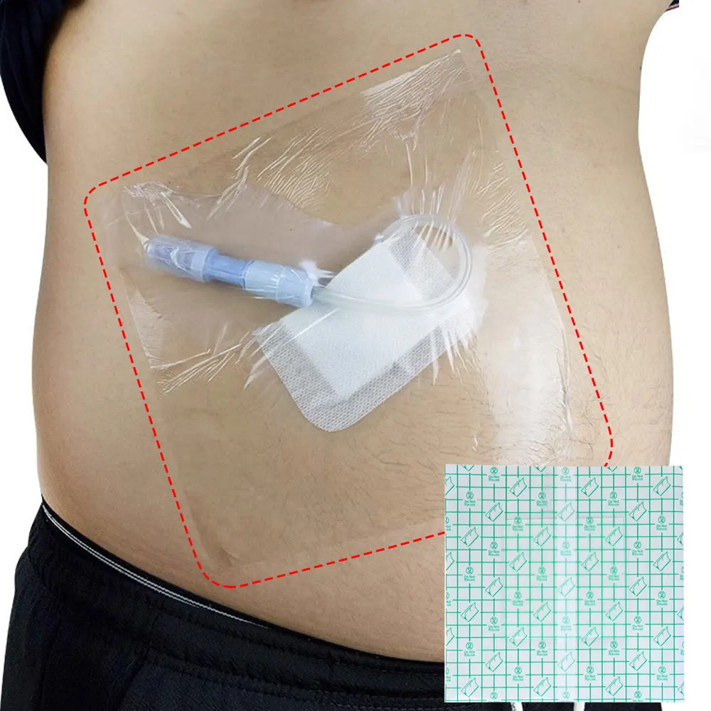 Waterproof Transparent Tape PU Film Medical Adhesive Plaster Anti-allergic Wound Dressing Tape First Aid Kit