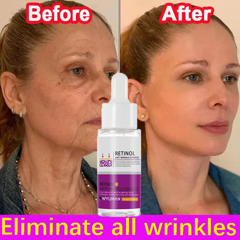 Retinol Remove Wrinkles Face Serum Lifting Firming Anti-Aging Fades Fine Lines Moisturizing Brighten Skin Care Korean Cosmetics