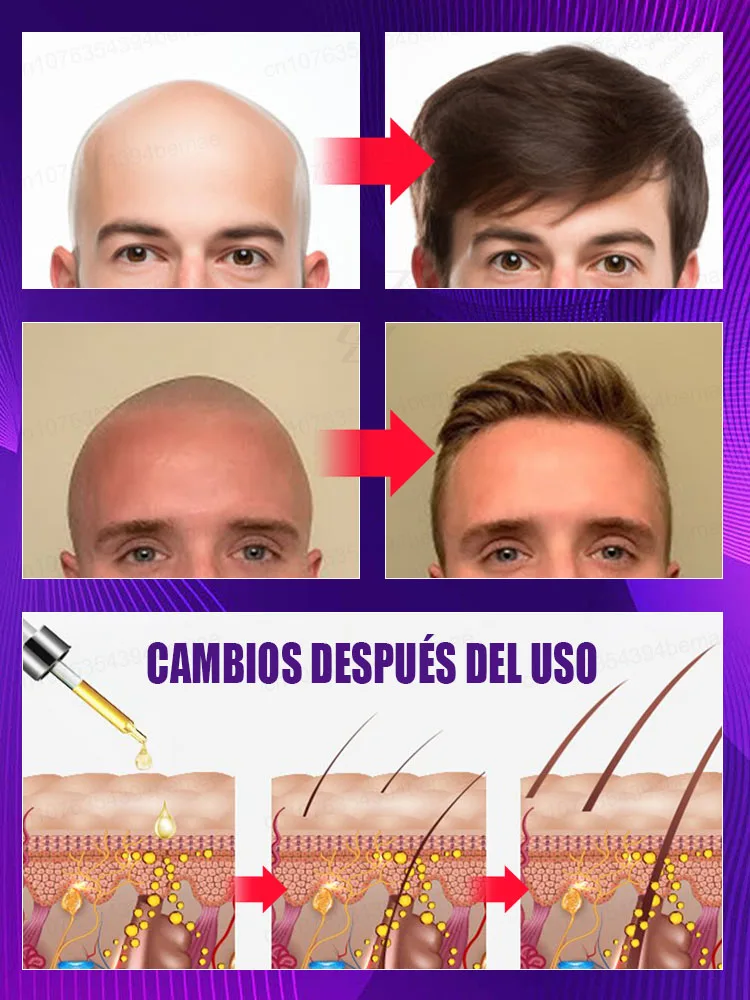 毛包を刺激し、頭皮に栄養を与え、7日間で髪を素早く再生します