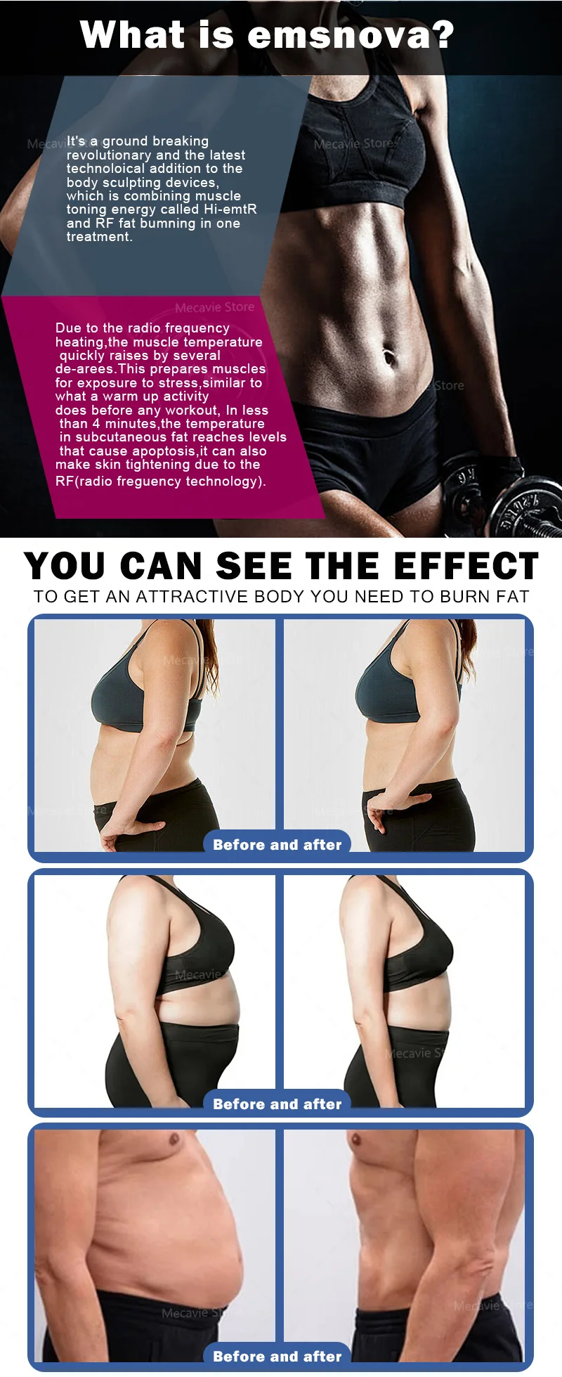 MECAVIE EMS Tragbares HIEMT-Gerät 6500 W 200 Hz Hochintensive elektromagnetische Therapie für den Körpermuskelstimulator