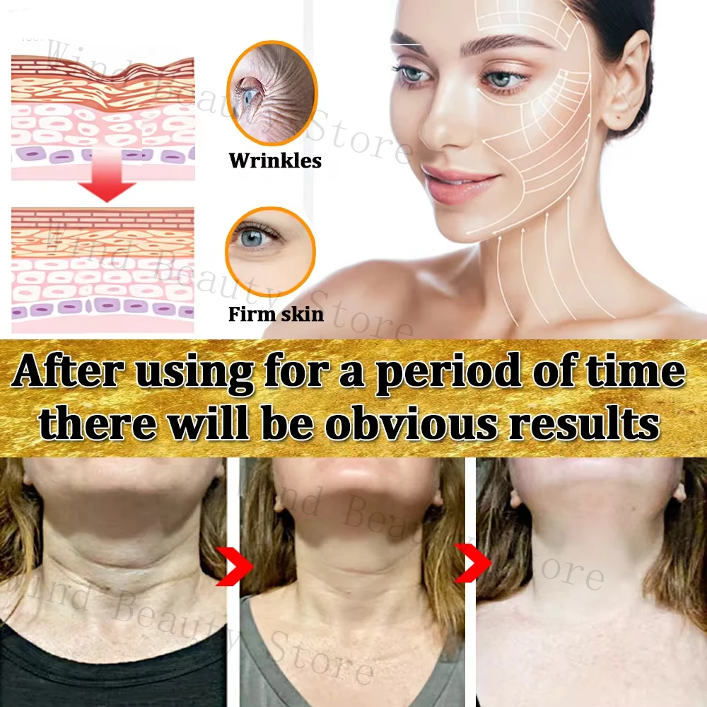 Retinol Wrinkle Removing Face Cream Anti-Aging Firming Lifting Fade Fine Lines Moisturizing Brighten Skin Care Korean Cosmetics