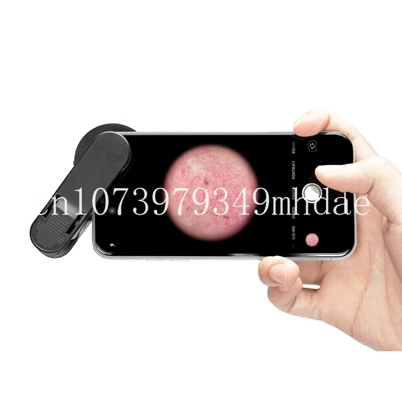 

Высококачественный объектив, дерматоскоп для кожной хирургии, дерматология, уход за кожей, дерматоскоп, диагностический набор
