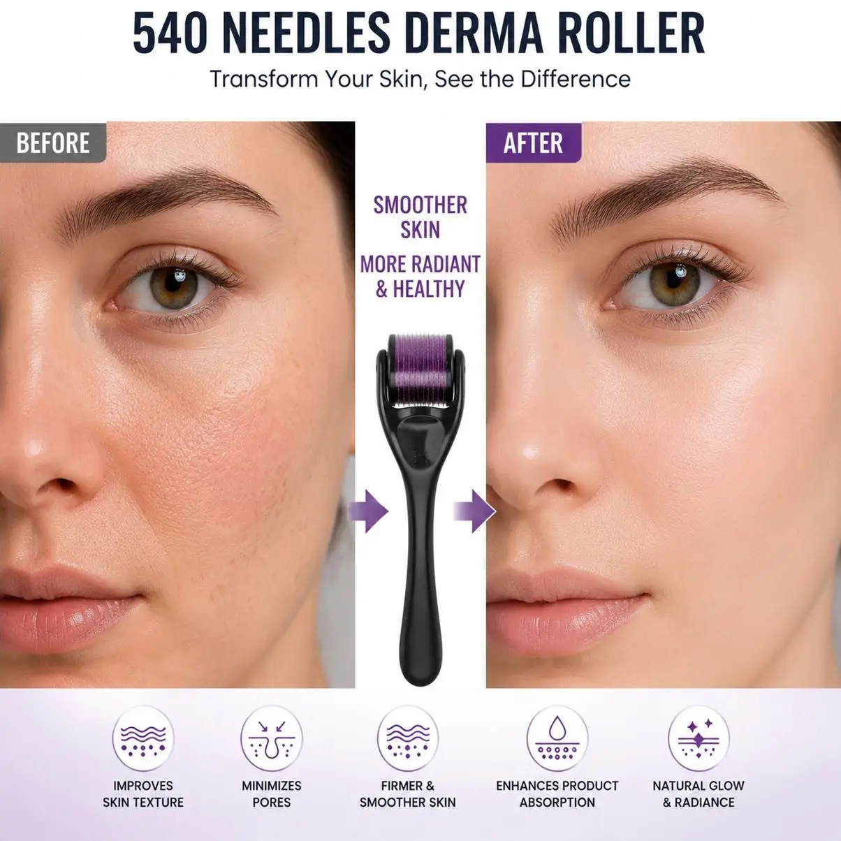 professional-microneedling-derma-roller-02mm-025mm-03mm-540-needles-hair-growth-acne-removal-titanium-material