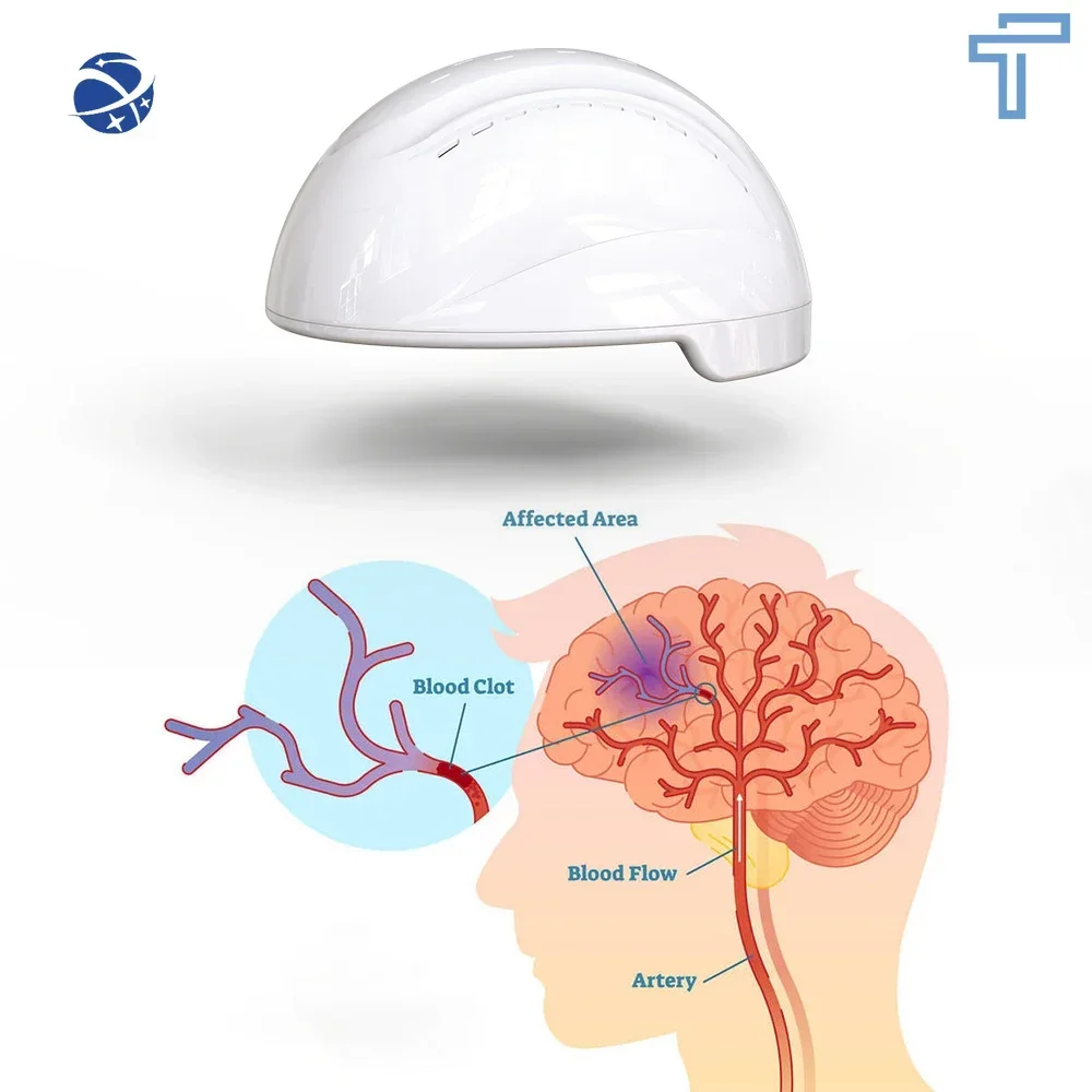 

Medical brain therapy LED led light therapy equipment infrared light therapy helmet for brain disorder