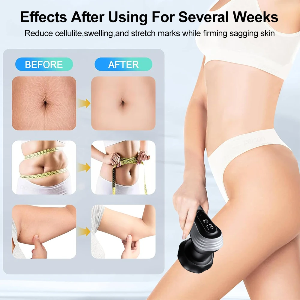 Body Cellulite Massager Electric Sculpting Machine Waist Neck Back Leg Body Fat Slimming Cordless Portable Deep Tissue Massage