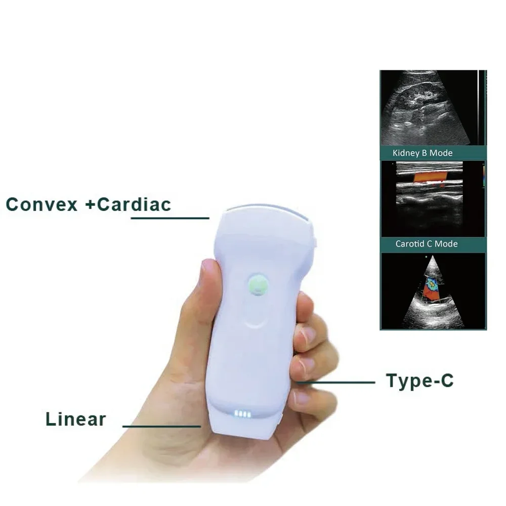 3 In 1 color doppler wireless ultrasound probe wifi and usb connect MSLPU80