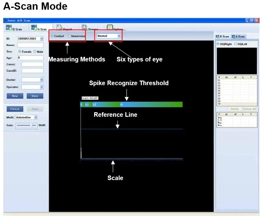 أداة طب العيون المحمولة من Holyavision، اختبار العين بالموجات فوق الصوتية، مسح AB #5