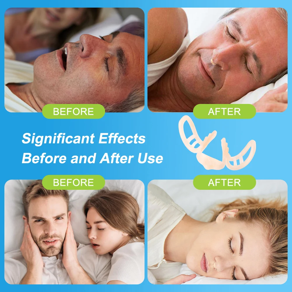 Anti Snore Nasal Dilator Stop Snoring Silicone Nose Clip Sport Easy Breath Nasal Clip Stop Snoring Aid Device Improve Sleeping