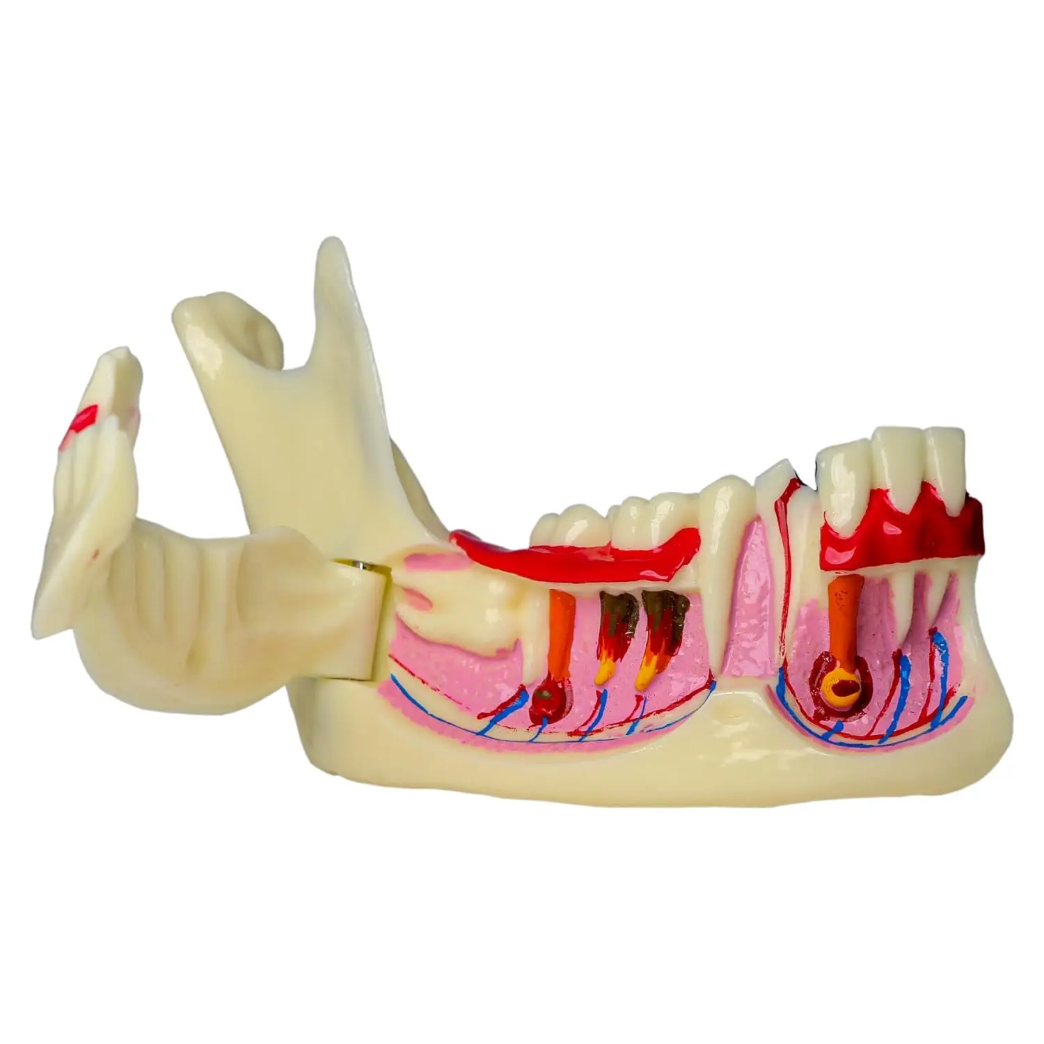 Dental Low Jaw Endodontic Model Anatomical Model of Right Mandibular Tissue Anatomical of Gingiva for Learning And Teaching