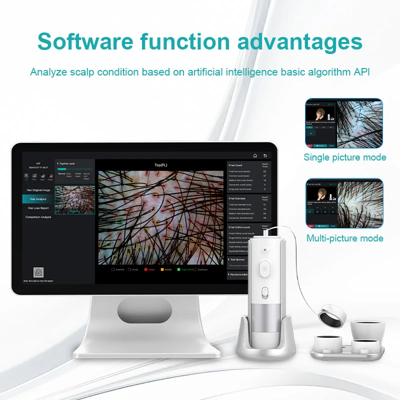 

AI Intelligent Analysis Hair Tester Skin Analyzer Analysis Scalp Care With Cloud Data Storage Hair Analysis Machine