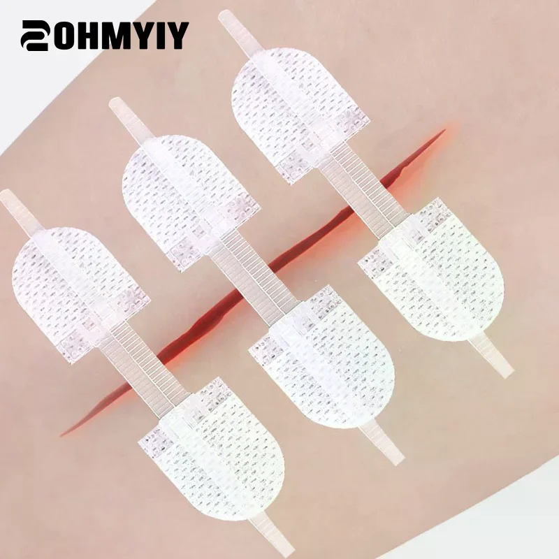 

45*10mm Strap Zipper Wound Closure Patches Breathable Seamless Elastic Zip Sutures Bandages For Wound Care Non Woven