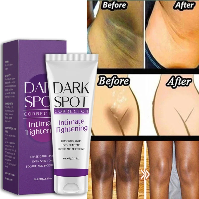 Quickly Whitening Cream Dark Skin Underarm Brightening Cream Inner Thighs Elbows Bleach Joint Remove Melanin Whitening Cream