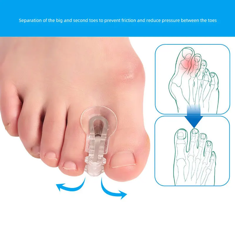 2PC Silicone Toe Splitter Correction Device, Large Foot Bone Separation Toe Sleeve Toe Splitter Manicure Tools For Hallux Valgus