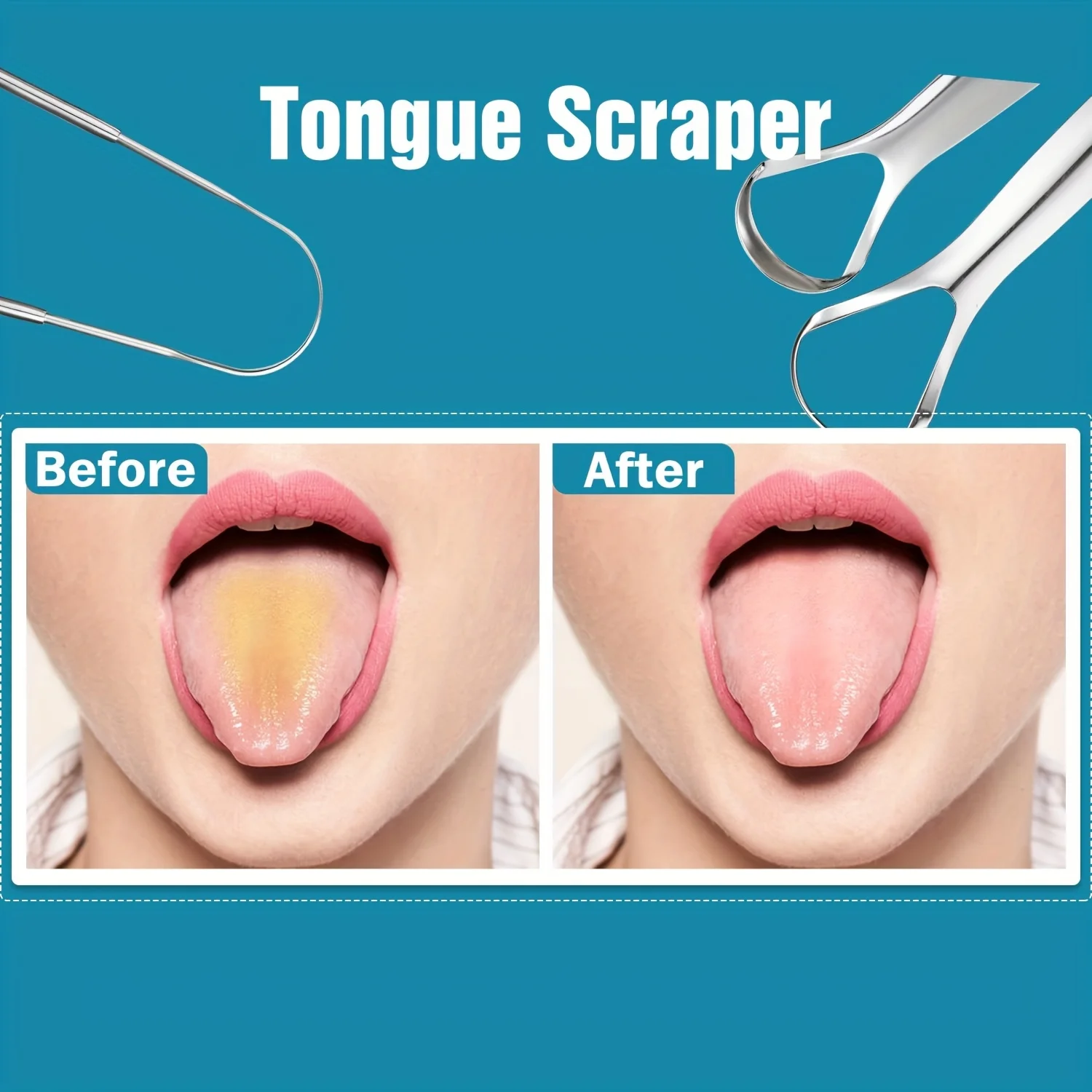 Thumbnail 2 - #57 Cheap Tongue Scrapers Worth Buying