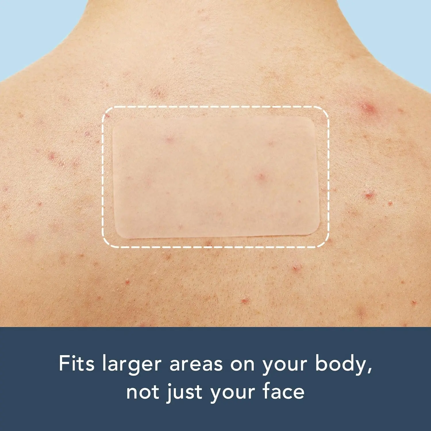 15 رقعة حب الشباب كبيرة الحجم وطويلة يمكن قطعها حسب الحجم وتمتص الشوائب بشكل فعال ومناسبة للوجه والجسم #4