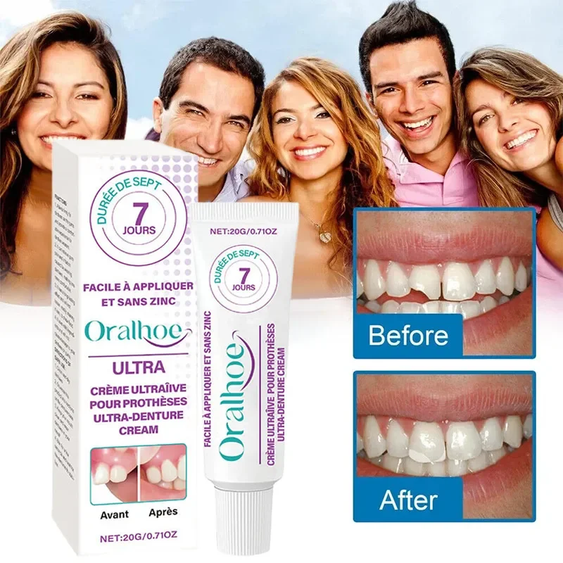 

Эффективный клей для протезов, уход за зубами, термопласт, силиконовый рельефный набор для протезов, клейкая подушка, фиксированный клей для протезов