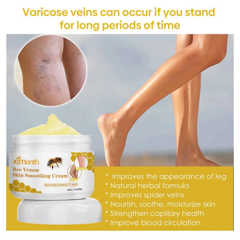 Bee Venom Vein Repair Cream To Relieve Leg Soreness and Swelling and Smooth Bulging Veins