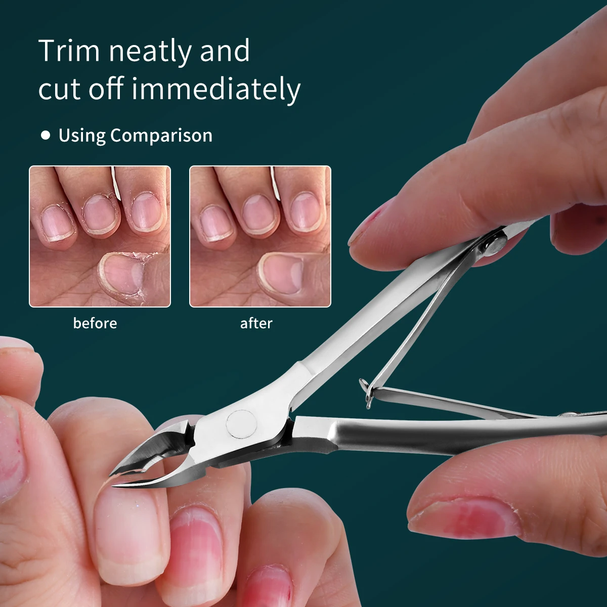 プロのキューティクルトリマーセット、女性と男性の爪と足の爪のための非常に鋭い角質はさみ、省力マニキュアツール