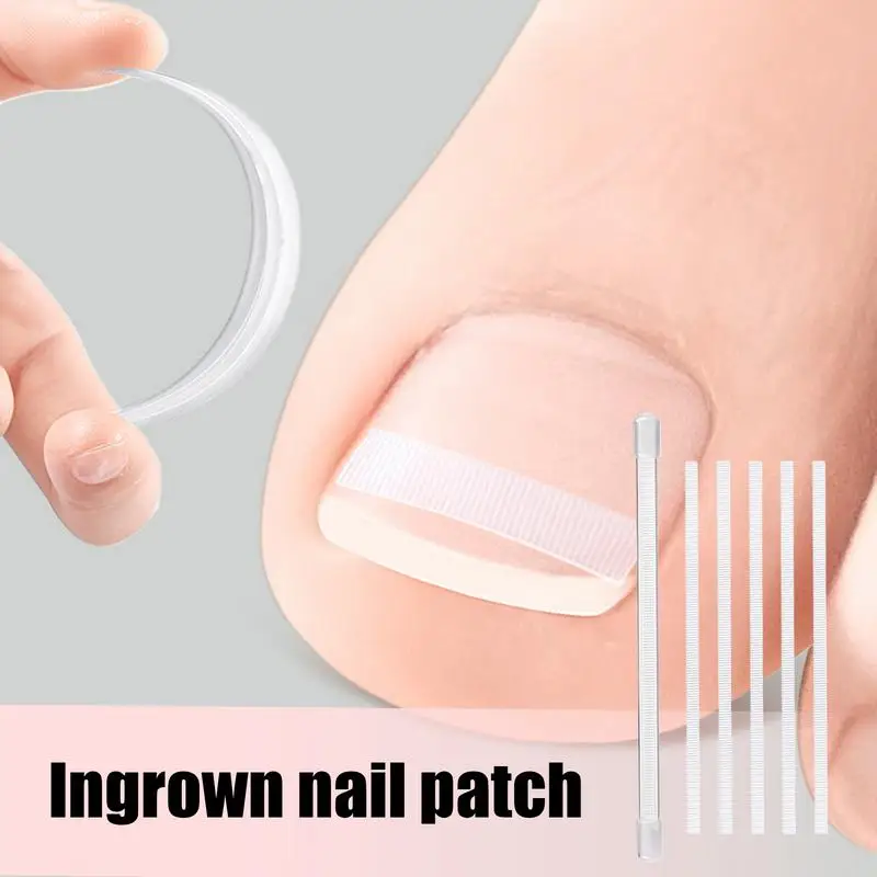 Ingegroeide teennagelcorrector 5-delig Comfortabel ingegroeide teennagelgereedschap Nagelverzorgingsset Lichtgewicht gebogen nagelreparatie Teennagel