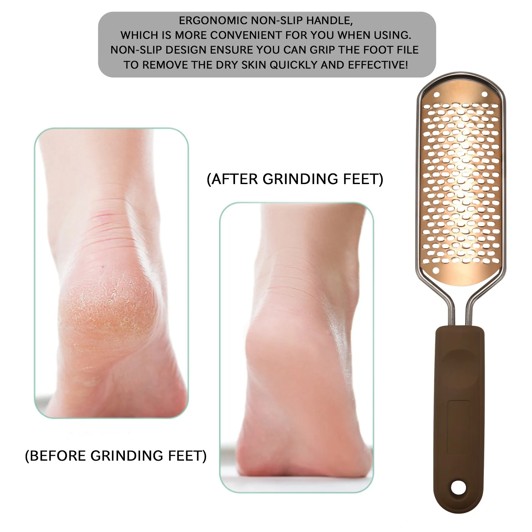 Lima de pedicura estable para pies, eliminador de callos, escofina grande para pies, depurador de pies colosal, herramientas para pies, salud de enfermería profesional