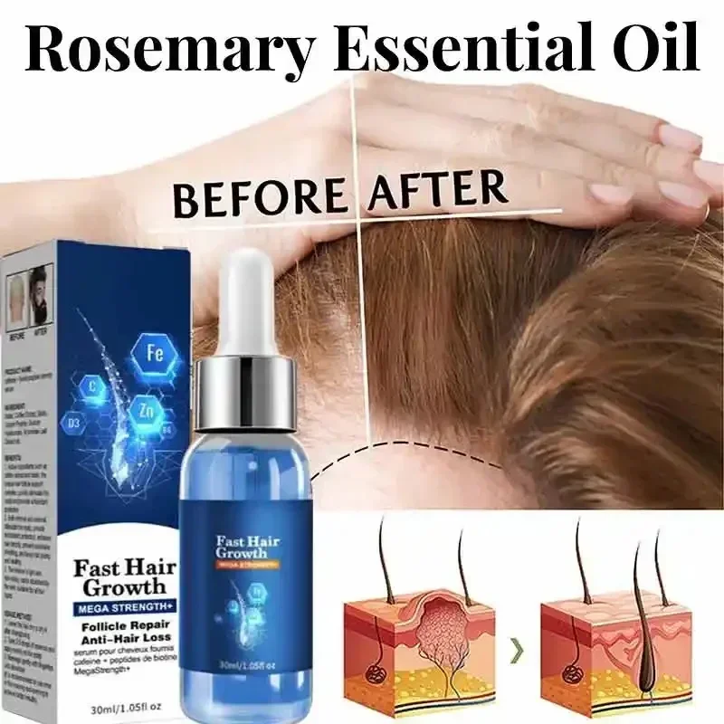 Fast Hair Growth Hair Growth Oil Effective Baldness Repair Hereditary Hair Loss Postpartum