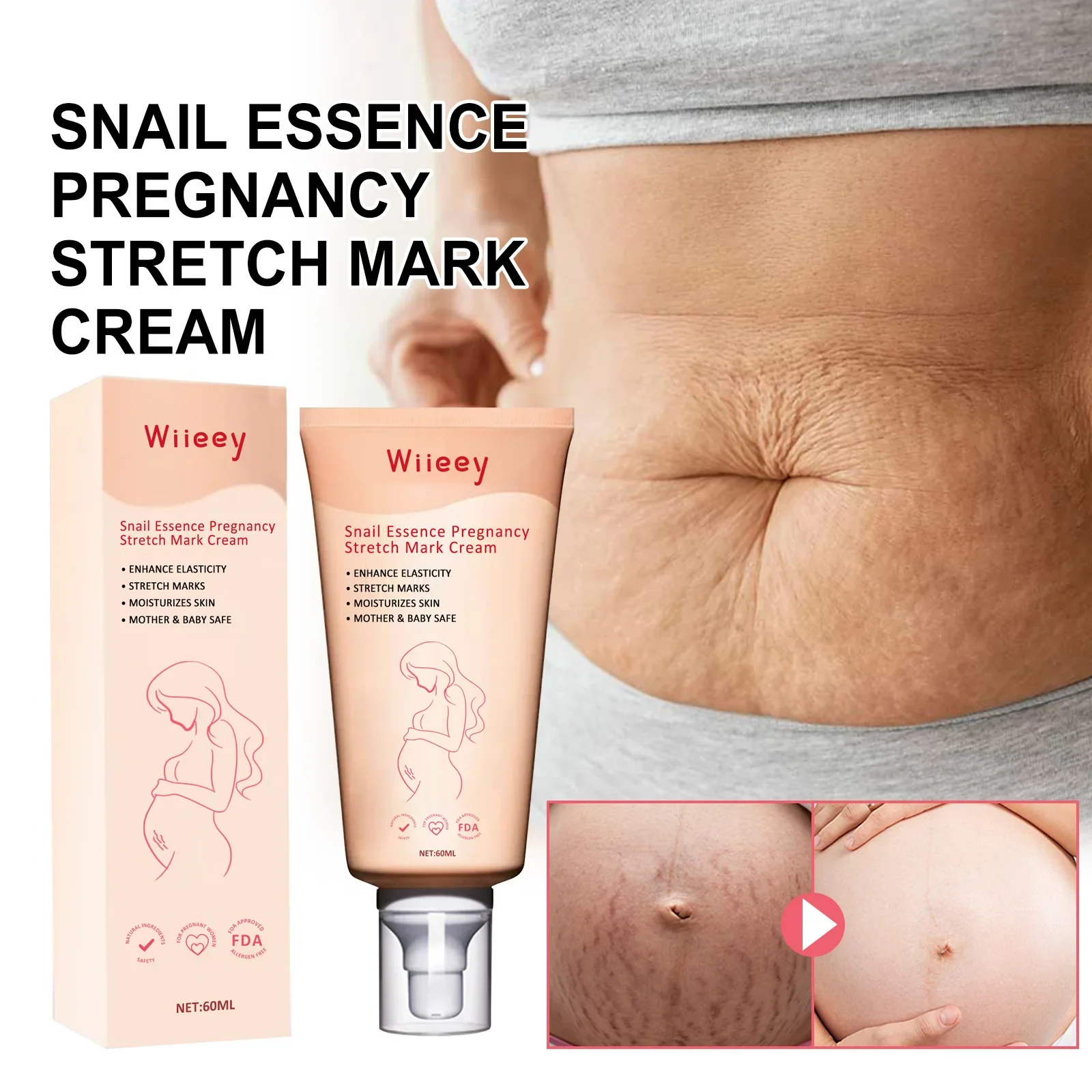 Snail essence Pregnancy Cream Firms Repairs and Lightens Postpartum Pregnancy Marks Pregnancy Fat Cream