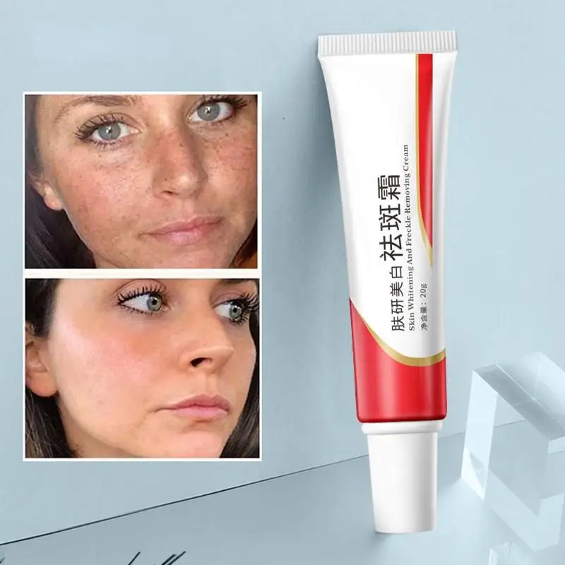 Skin Whitening Cream Moisturizing and Anti-freckle Cream Repairs The Skin and Facial Skin Care Products