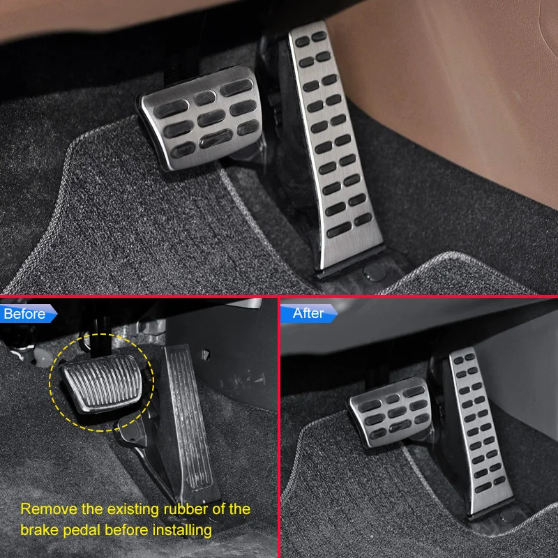 For Hyundai Sonata Tucson Santa Fe Cruz Palisade Kia Sportage Sorento Stinger Optima K5 Steel Brake Gas Pedal Pad Plate Cover