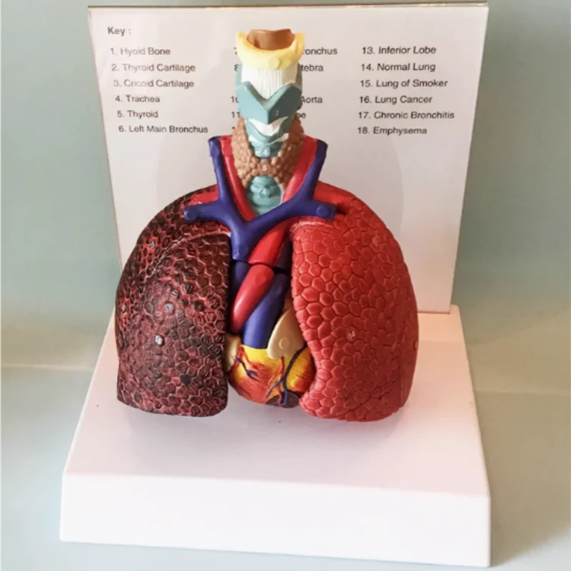 

Личкокс человека, модель сердечно-легочного легкого, сердце, личинка, трахея, лимфа-гинсы, медицинская грудная хирургия