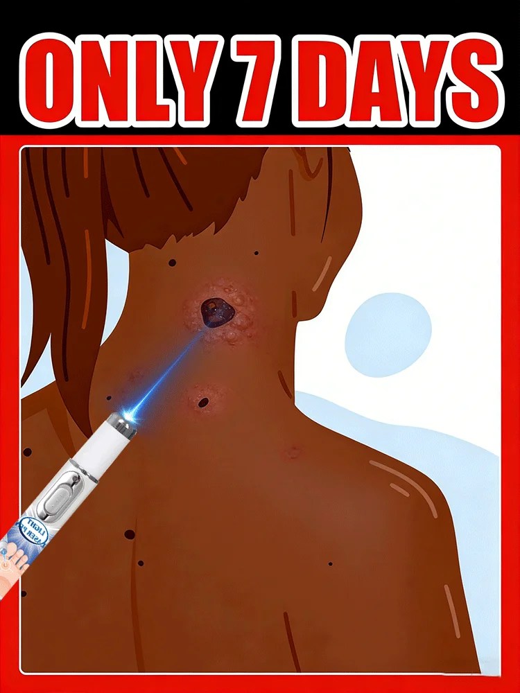 

Средство для удаления шрамов в домашних условиях, суперэффективное! Горячие продажи 2026: Всё будет хорошо.