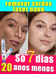 laser nano Pontos faciais se foram