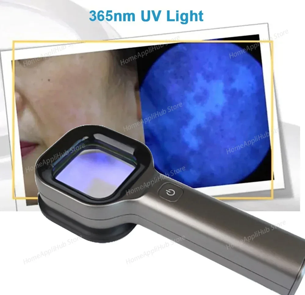 

Woods Light Skin Examination For Cat Dog Ringworm Handheld UV Wood's lamp Skin Fungus Detector Vitiligo Pityriasis Versicolor