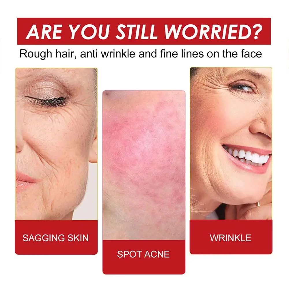 Rose Hip Seed Oil Essence Fade Wrinkle Anti Black Face Oil Oil Natural Moisturizing Hydrating Castor Seed Care Prod Y7z8