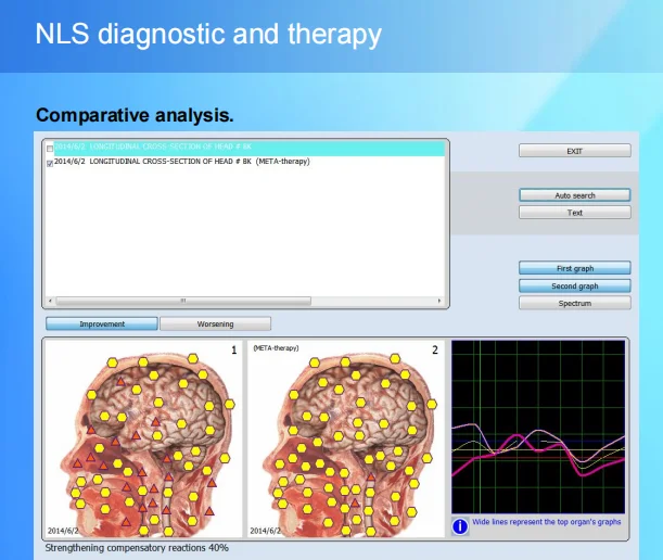 9D NLS Bioresonance Machine Meta Therapy Vegeto Reprinter Vera-Test Spectrum Etalon-Object CELL Diagnostics Sub Body Health