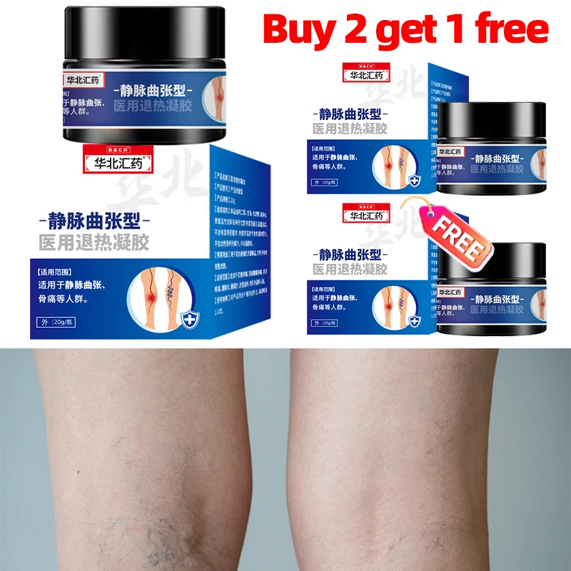 

3Boxes Varicose Veins Remover Herbal Cream Varicosity Spider Legs Angiitis Vascular Veins Treatment Medical Plaster Vein Care