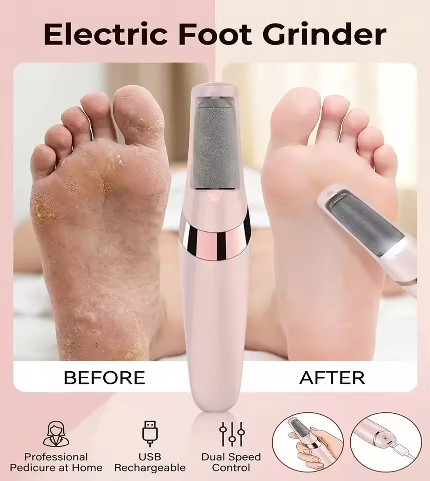 Cordless Rechargeable Electric Callus Remover, Foot File for Dry Coarse Skin Removal on Heels, for Women & Men