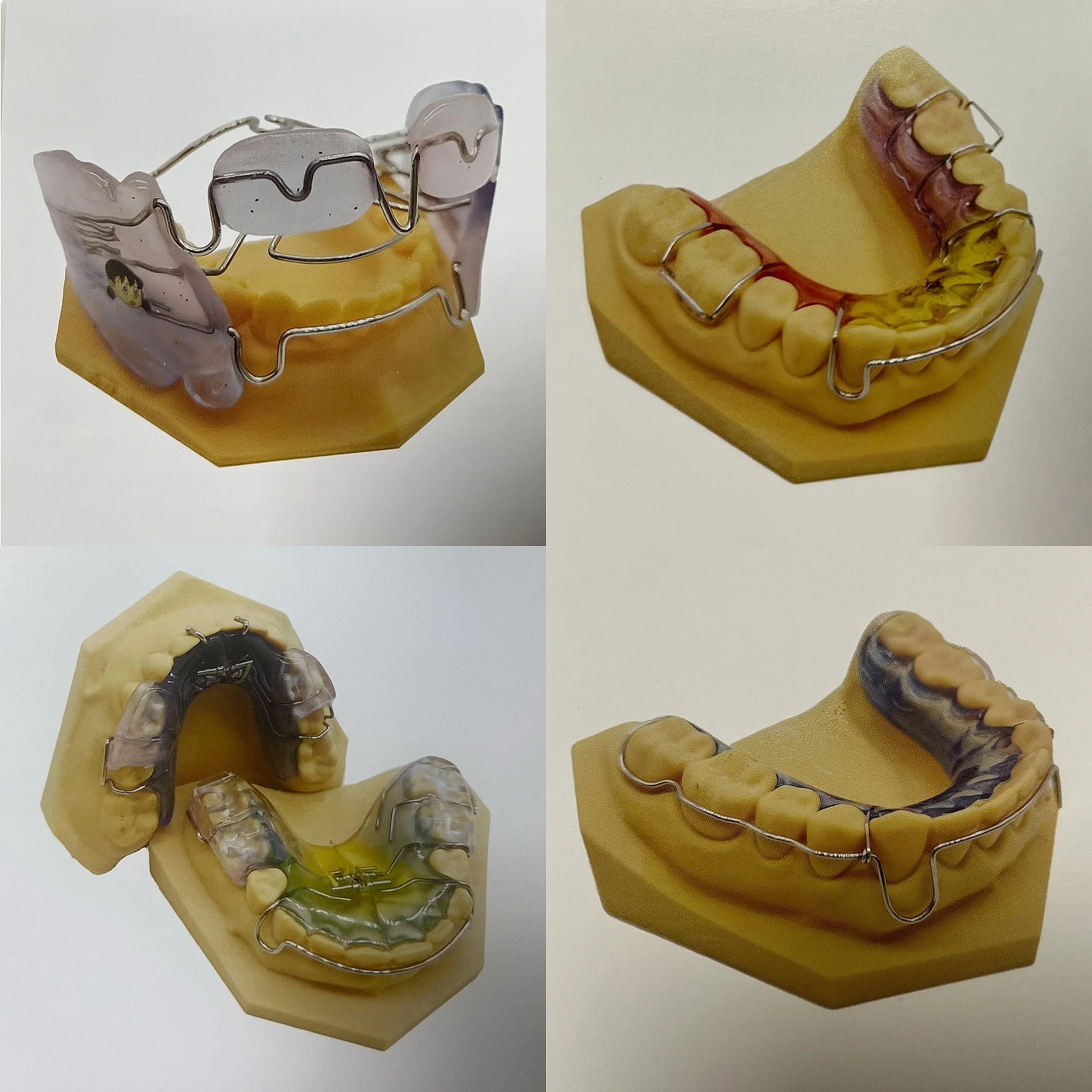 Dentals Orthodontic Functional Appliance Manual Teeth Model Frankel Hawley Nance TPA Twin-Block Wrap Around Retainers Set