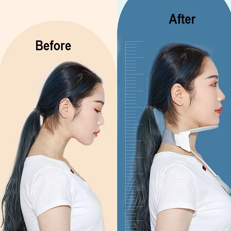 Protection Of Neck With Slim Neck Collar Household Cervical Collar Adult Children Forward Correction Hunchback Posture Orthotics