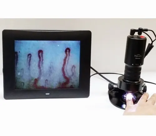 DMX980-1 microcirculation microscope