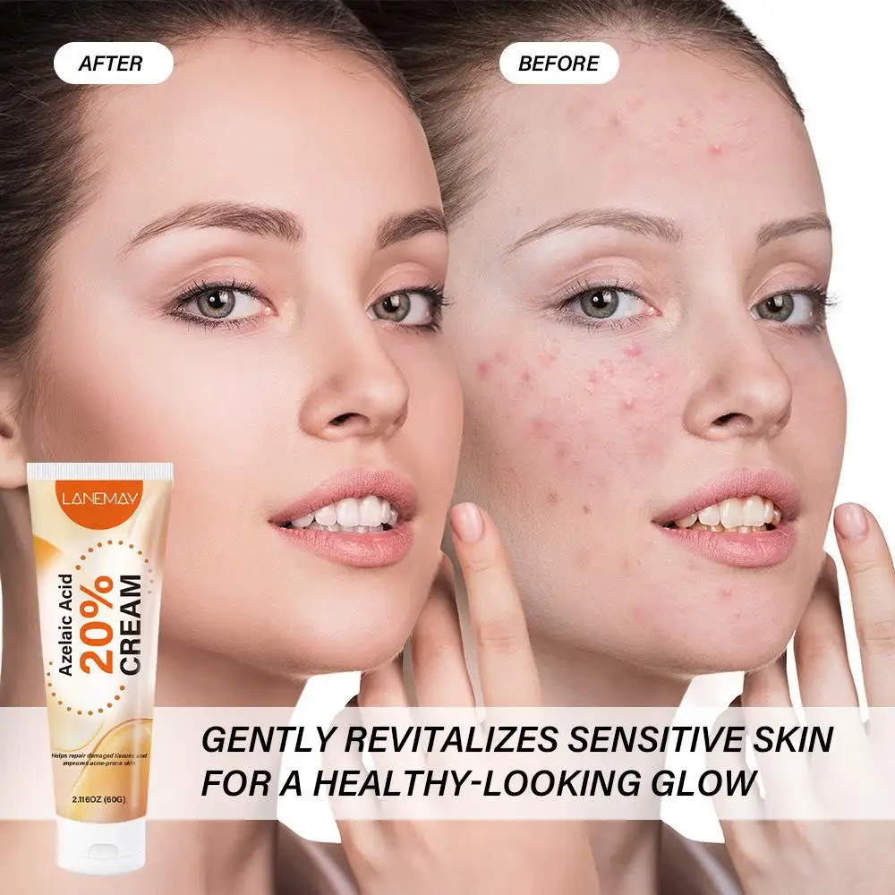 60g Brightens Skin Tone Cream Gel Dead Spot Improves Brighten Peeling Gentle Repair Scrub Hydrating Moisturizer Korean Skin Care