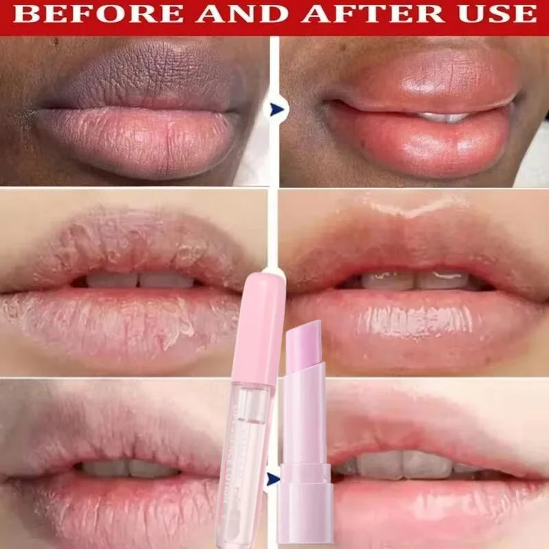 

Fast Remove Dark Lip Balm Serum Lighten Melanin Lip Mask Exfoliating Fade Lip Lines Dead Skin Nourishing Repair Lip Care Makeup