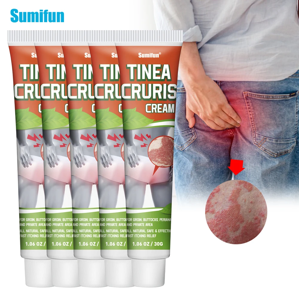 

1/3/5Pcs Sumifun Tinea Cruris Cream Treat Psoriasis Femoral Moss Antibacterial Ointment Eczema Dermatitis Skin Itchy Plaster 30g